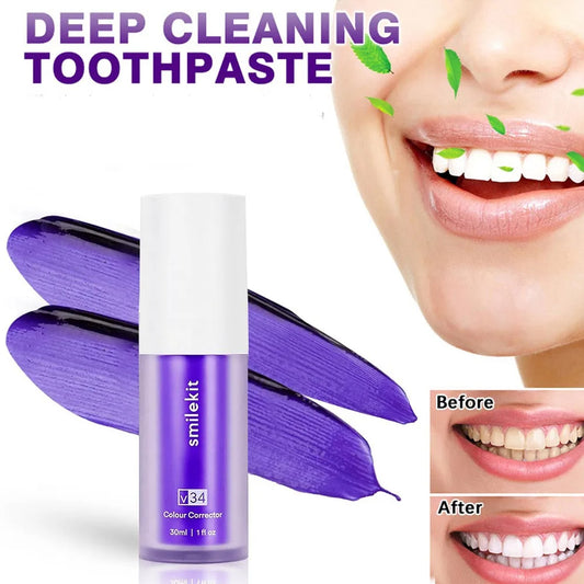 HiSmile V34 Teeth Whitening Kit – Professional