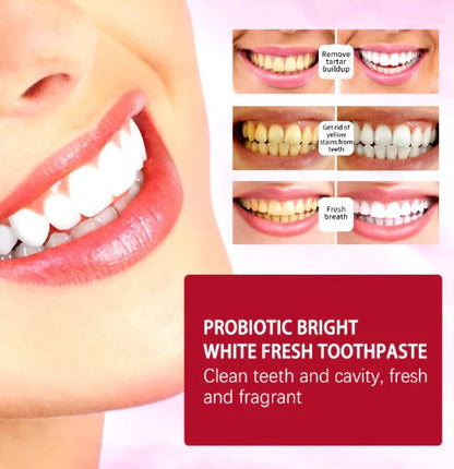 SP-4 Whitening Toothpaste – Stain Removal Formula